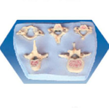  寰、樞、頸、胸、腰椎模型KAR/11137  