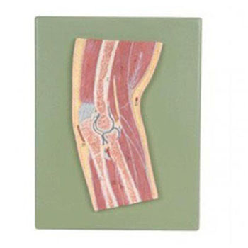  肘關(guān)節(jié)剖面模型KAR/11203  