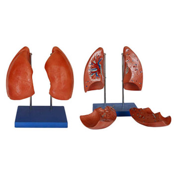 益聯(lián)左右肺模型 YLM/A321 